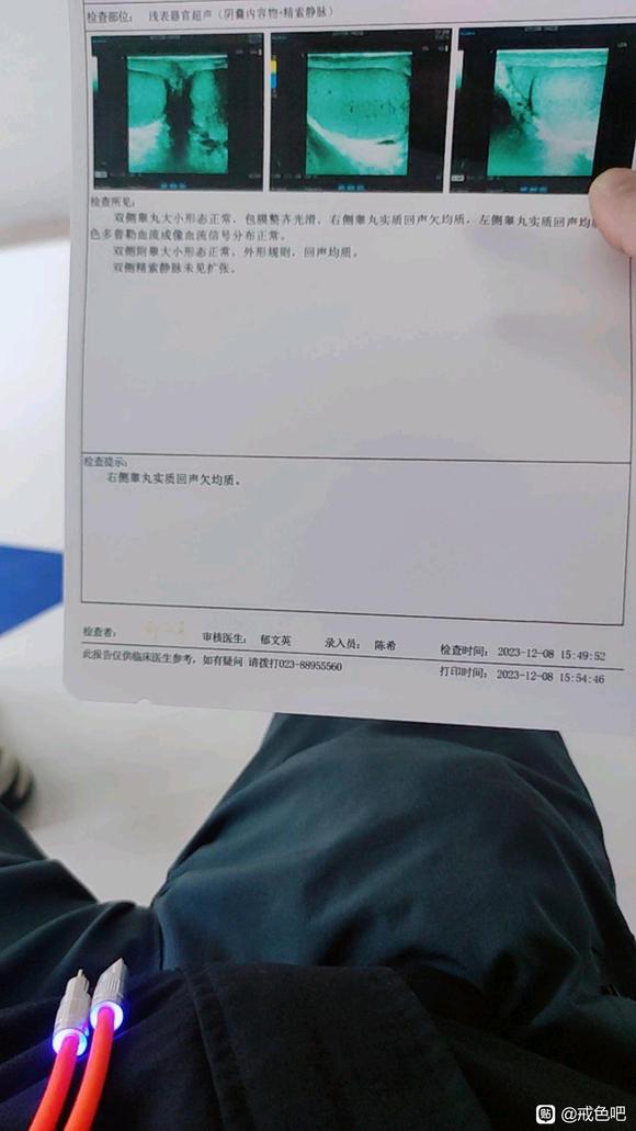 ”戒色真的能治疗好精索静脉曲张！！！