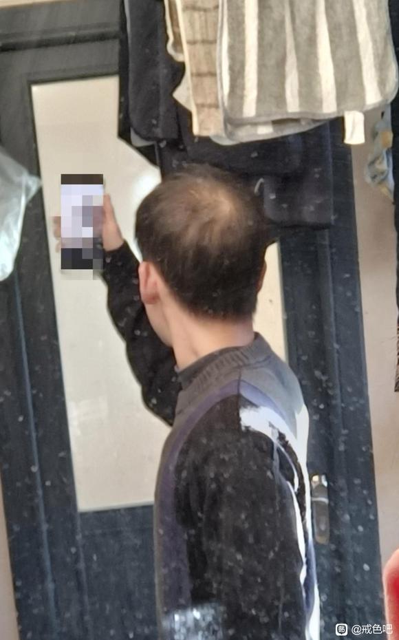 ”脱发严重还能恢复吗？