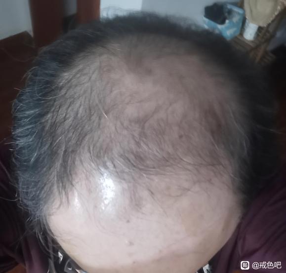 ”lu成这样了，废了