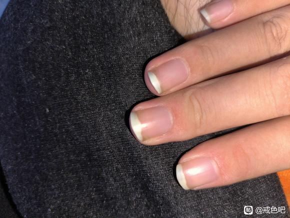 ”手指甲发白