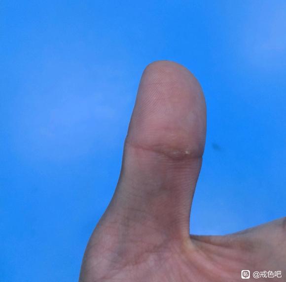 ”大家有这种情况吗