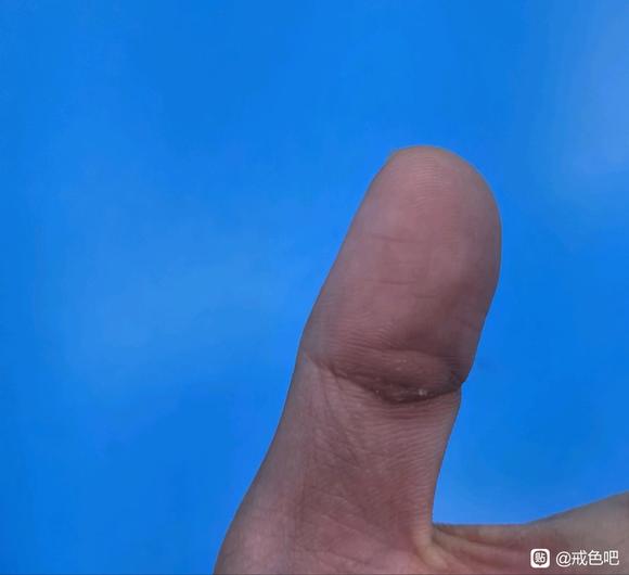 ”大家有这种情况吗