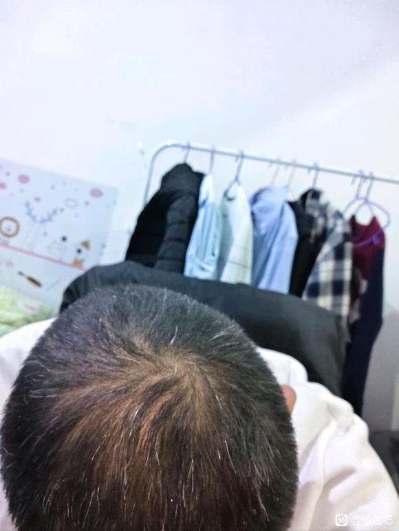 ”像我这样的头发得多久恢复