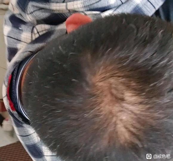 ”像我这样的头发得多久恢复