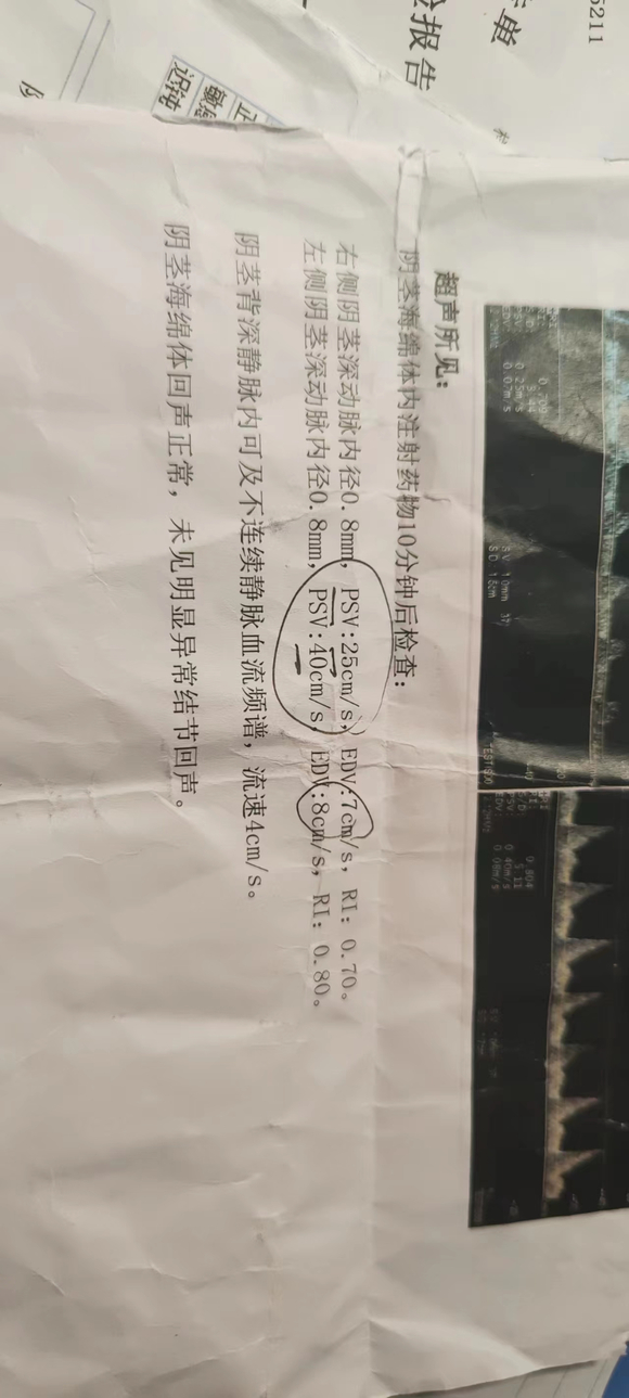 ”9岁开始手淫，14年手淫史，阳痿6年，熬夜10年，戒色打卡。