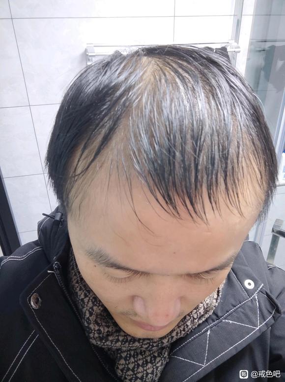 ”冬季要注意养生和保暖，不要纵欲，节约精力，努力上进