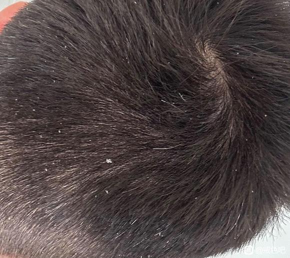 ”长期遗精须发早白