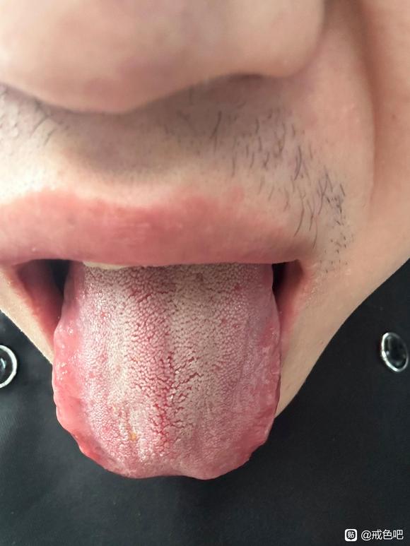 ”请个大家帮忙看看