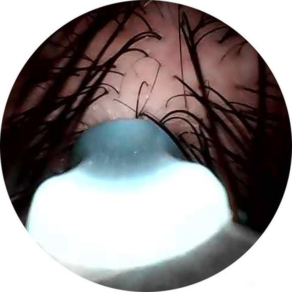 ”新生头发细软