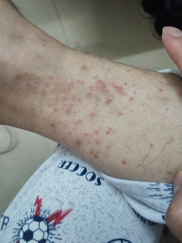 ”熬夜和灰机太多