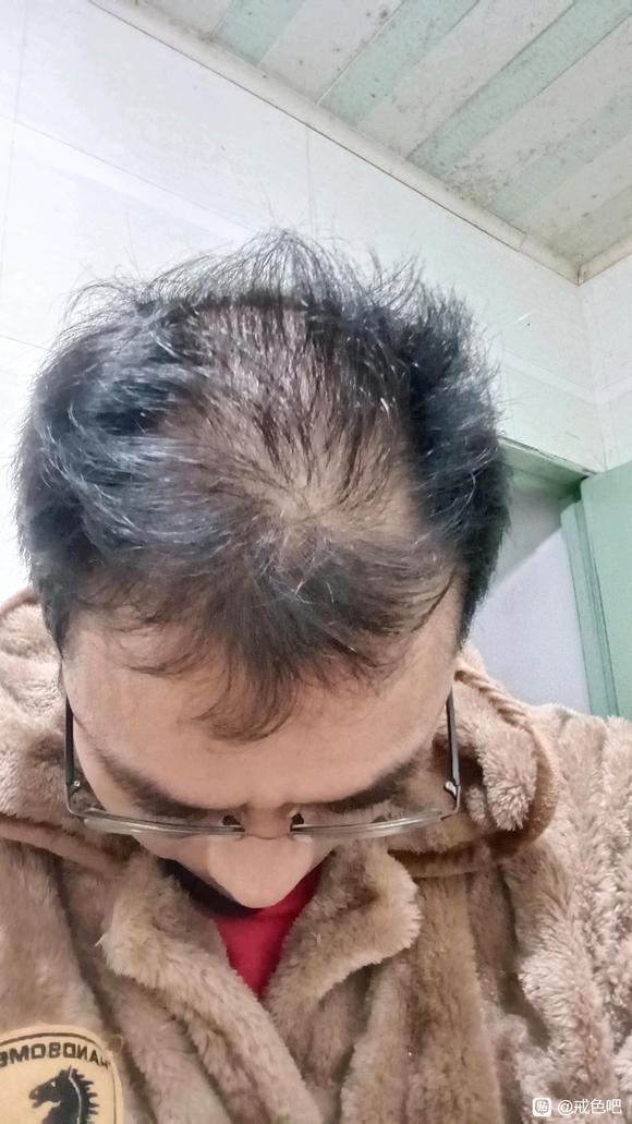 ”#微信看病卖药是假的#天天打飞机全身没劲