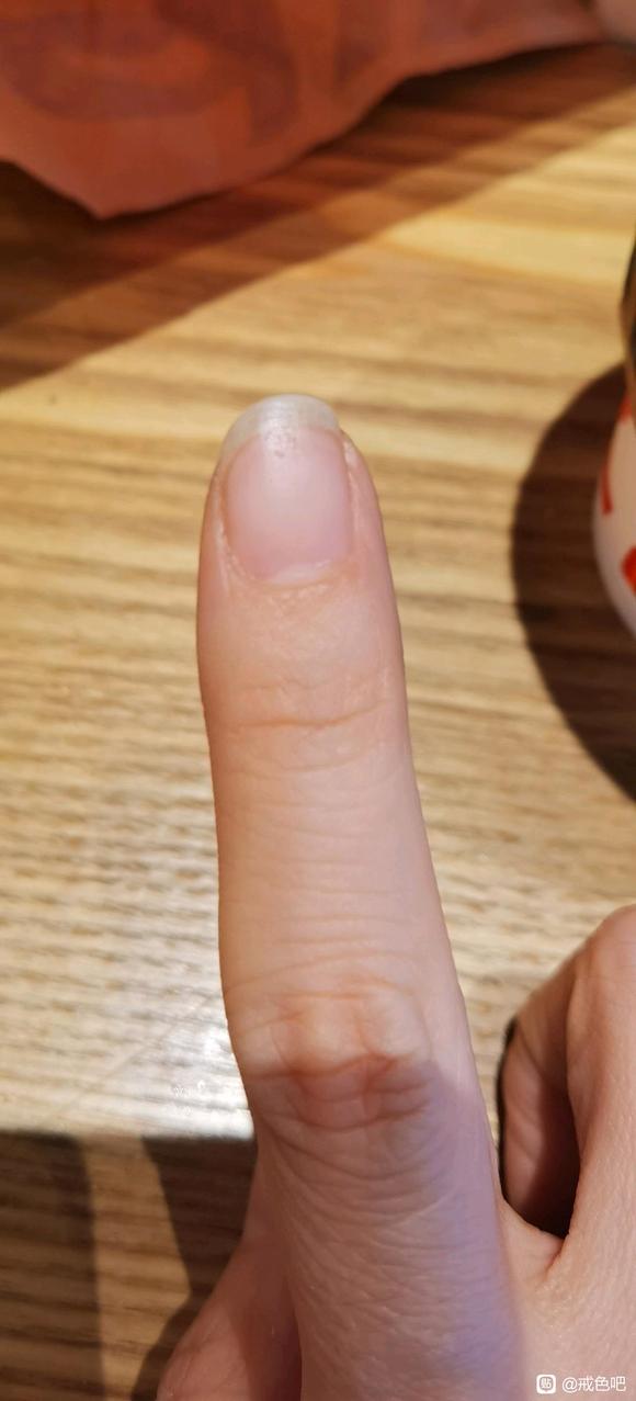 ”#微信看病卖药是假的#已经一个小月牙出来了，更加坚定戒色！